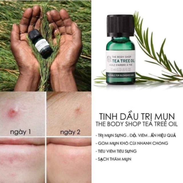 Tinh dầu tràm trà giảm mụn Tea Tree oil The Body Shop | BigBuy360 - bigbuy360.vn