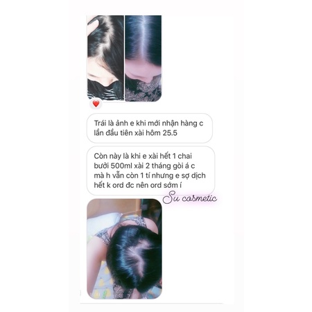 Dầu Gội Bưởi Cô Đặc ‍♀️Dầu Gội Thảo Dược Sạch Gàu, Nấm Ngứa Giúp Kích Mọc Tóc Giảm Tóc Bết .
