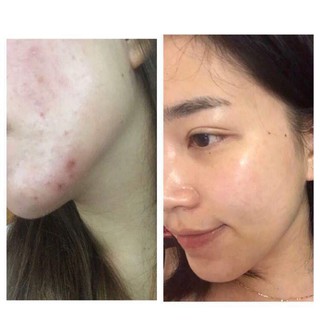 Sữa rửa mặt CERAVE