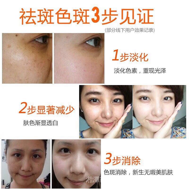 Bộ kem làm trắng xóa thâm đốm sắc tố melanin tàn nhang trẻ hóa da sáng và buổi tối
