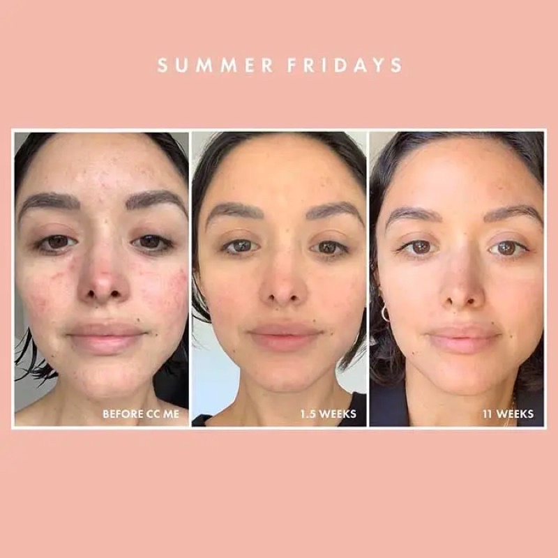 Kem dưỡng chống lão hoá trẻ hóa làng da ban ngày Olay Regenerist Vitamin C + Peptide 24 Moisturizer SPF 30 USA