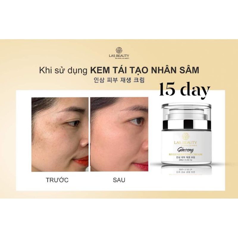 KEM TÁI TẠO DA NHÂN SÂM LAS BEAUTY TỪ HÀN QUỐC | BigBuy360 - bigbuy360.vn