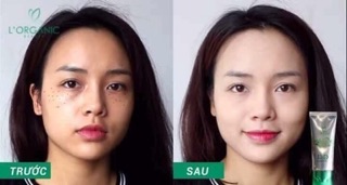 Kem nền DD 6 trong 1