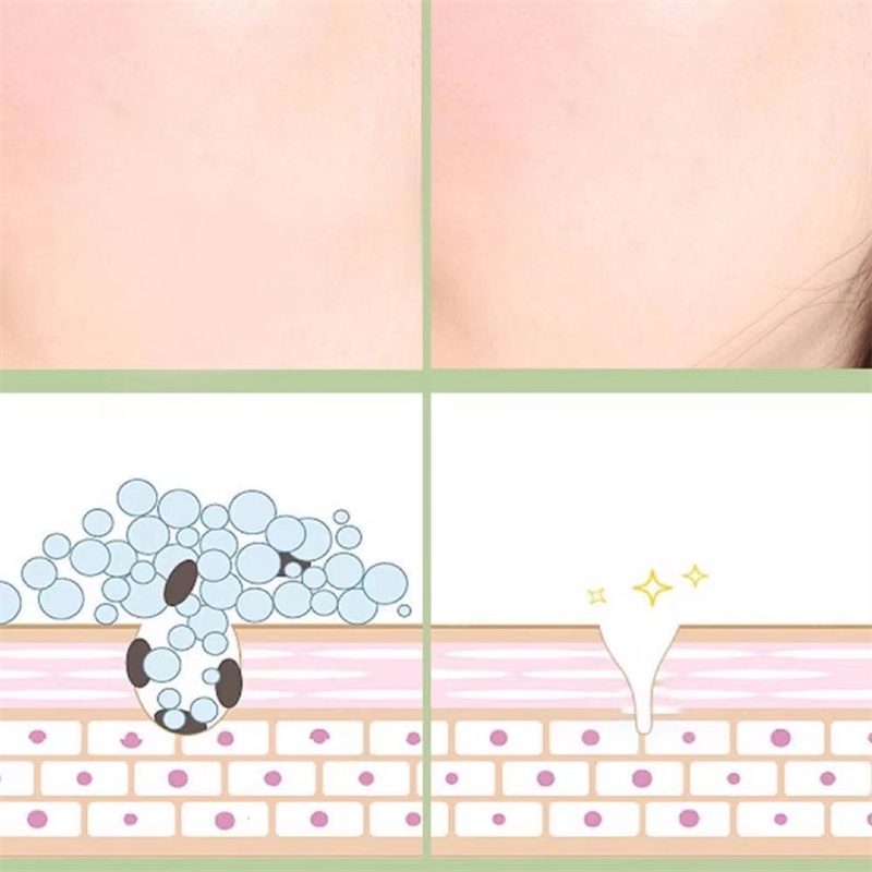 Abpopa ZHUOZHUANG® Mặt Nạ Chiết Xuất Bơ Dưỡng Ẩm Làm Sáng Da Se Khít Lỗ Chân Lông
