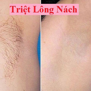 Mỡ trăn nguyên chất N STORE triệt lông, mỡ trăn N STORE wax lông 75g gia nhiệt Chính Hãng T01