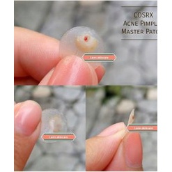 Miếng dán mụn COSRX ACNE PIMPLE MASTER PATCH