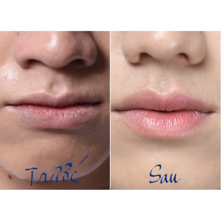 Son Dưỡng Môi Cho Nam - Dưỡng Môi Nam Blueman Giúp Cấp Ẩm Giảm Nứt Nẻ Bong Tróc - Hudu Cosmetics