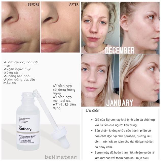 [AUTH, BILL MỸ] Tinh Chất The Ordinary Niacinamide 10% + Zinc 1% Giảm Mụn, Thâm [SeeMe beauty] SE-005