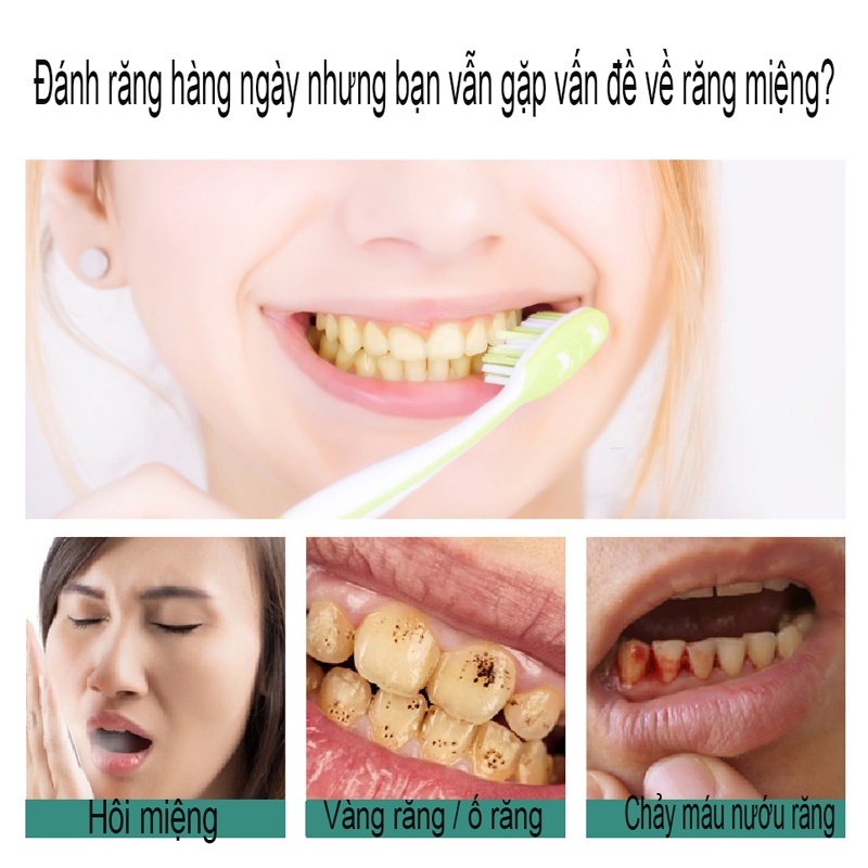 Kem Đánh Răng Làm trắng răng kem đánh răng 180g loại bỏ mảng bám trên răng nhanh chóng ố cao răng ngăn ngừa hôi miệng