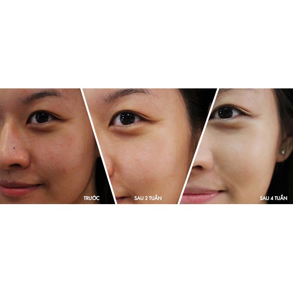 [CHÍNH HÃNG] SET 4 CHAI TINH CHẤT DƯỠNG DA BERGAMO LUXURY GOLD COLLAGEN SEỦM5 | BigBuy360 - bigbuy360.vn