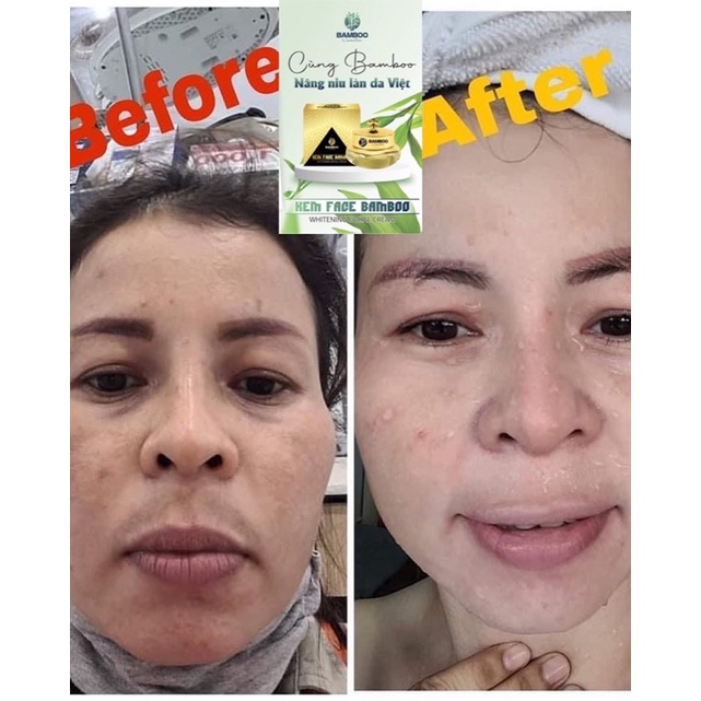 🎋𝗖𝗵𝗶́𝗻𝗵 𝗛𝗮̃𝗻𝗴 𝗕𝗮𝗺𝗯𝗼𝗼-𝗚𝗶𝗮́ 𝗖𝘁𝘆🎋Set Kem Face+Serum Bamboo - dưỡng trắng nhanh,căng bóng