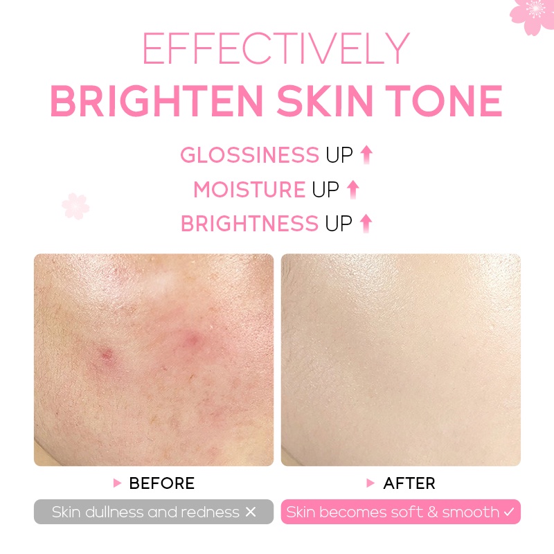 Serum Hoa Anh Đào Fenyi Làm Sáng Tông Màu Da 17ml