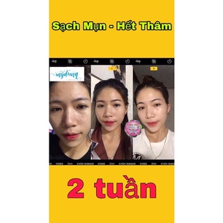 [FREESHIP] [CHÍNH HÃNG] Kem Mụn Thảo Dược Hoa Đào 2 weeks