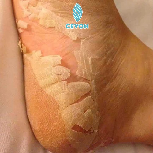 Ủ da chết chân FOOTMASK CEVON - bye bye gót chân nứt nẻ - mịn màng như da em bé