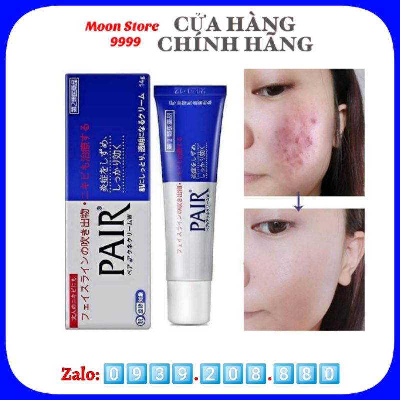 Kem Ngừa Mụn Pair Acne Nhật Bản Tuýp 24G