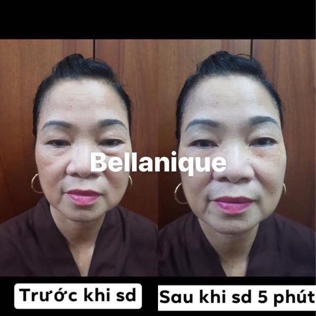 Kem mắt Bellanique bellanic HànQuốc | BigBuy360 - bigbuy360.vn