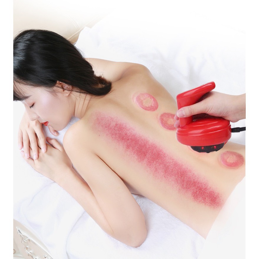 [FREESHIP] MÁY MASSAGE CẠO GIÓ, GIÁC HƠI ĐIỆN TỬ