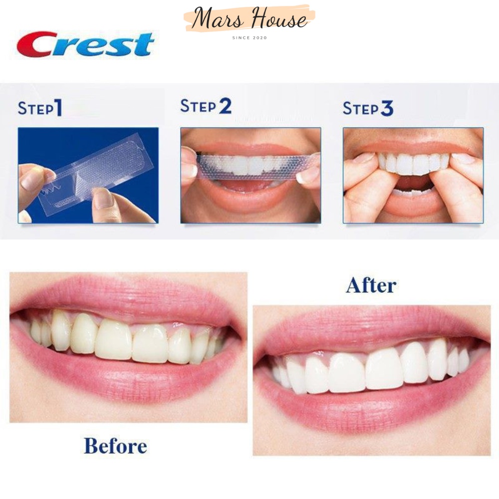 Miếng Dán Trắng Răng Crest