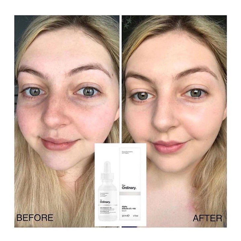 Serum The Ordinary - ALISA | BigBuy360 - bigbuy360.vn