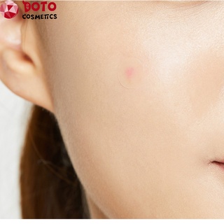 🍎 Miếng Dán Mụn Cosrx [AUTH - FREESHIP] Acne Pimple Master Patch 🍎