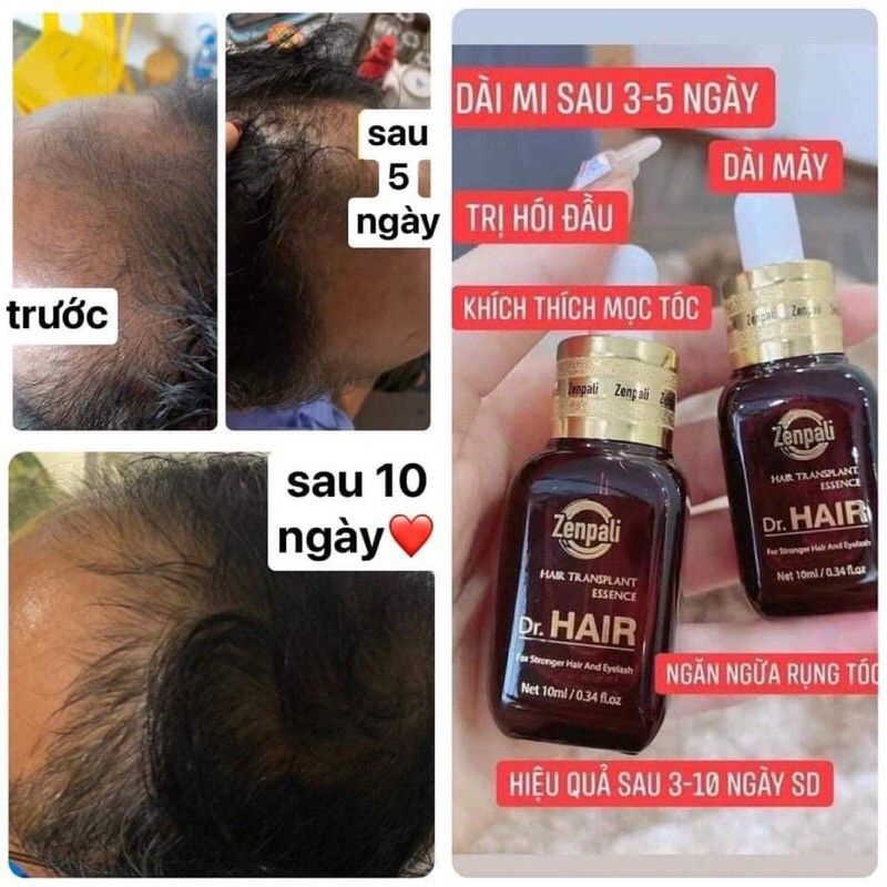 Tinh Dầu DR HAIR chính hãng