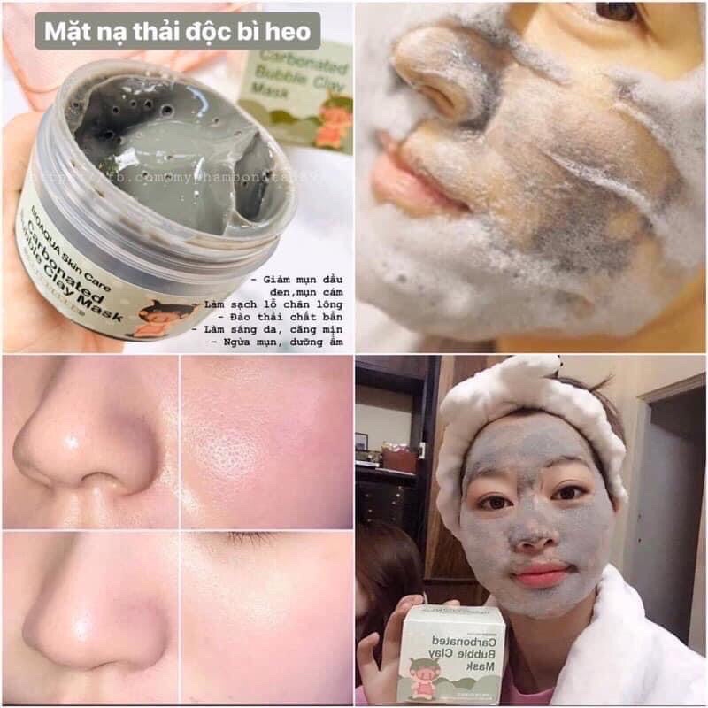Mặt Nạ Sủi Bọt Thải Độc Bì Heo
