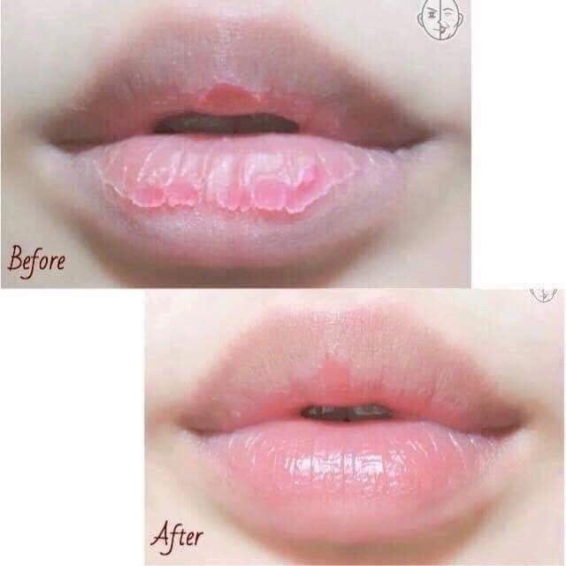 DƯỠNG MÔI THẦN THÁNH TỪ BUBI BUBI LIP AMPOULE (T8/2022)