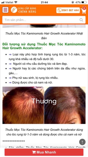 Thuốc mọc tóc KAMINOMOTO