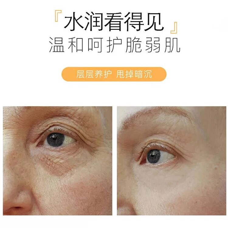 Tinh Chất Vitamin C/Vitamin C/Vitamin C Dưỡng Ẩm Làm Trắng Chăm Sóc Da