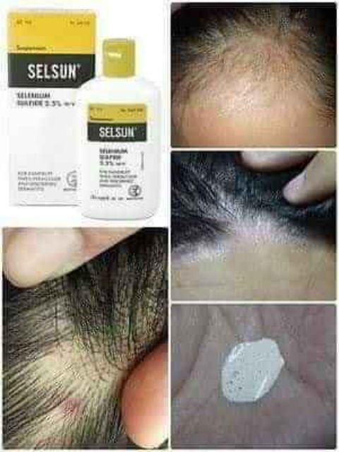 DẦU GỘI SELSUN THÁI LAN