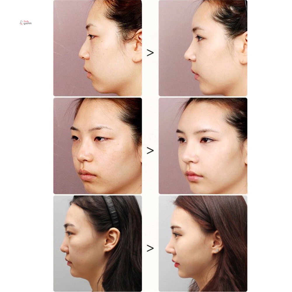 Tinh dầu mát xa tái tạo nâng xương mũi làm đẹp hiệu quả dành cho phái nữ