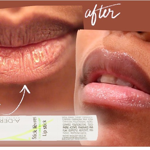 SON DƯỠNG A-DERMA LIP STICK 4G- SON DƯỠNG ẨM VÀ BẢO VỆ MÔI