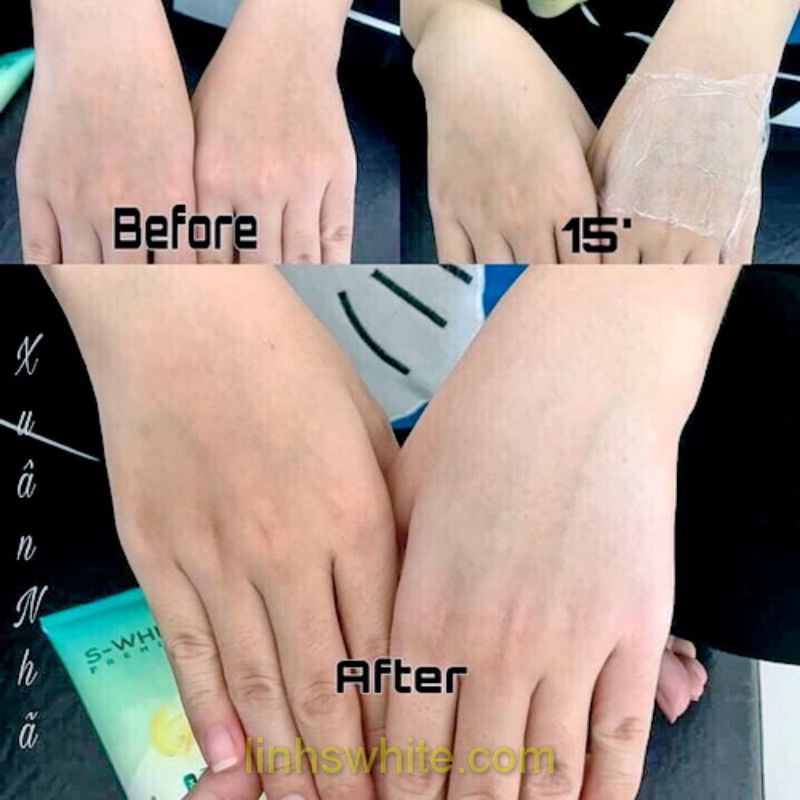 kem ủ trắng body dưa gang Swhite NSX 2021 | BigBuy360 - bigbuy360.vn