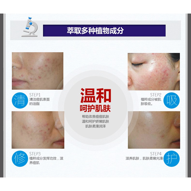 Kem Ngừa Mụn Pure Skin Bioaqua Viêm, Mẩn Đỏ, Sưng Tấy, Mờ Sẹo, Thâm Mụn, Thu Nhỏ Lỗ Chân Lông, Kiểm Sát Dầu Chính Hãng | BigBuy360 - bigbuy360.vn