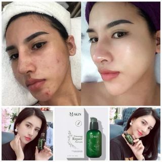 Serum Sâm hoàn hảo