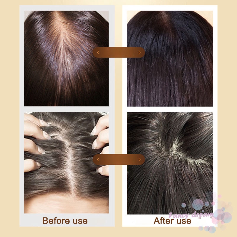 Tinh Dầu Chăm Sóc Tóc Chứa Tinh Chất Gừng Giúp Giảm Rụng Tóc | BigBuy360 - bigbuy360.vn