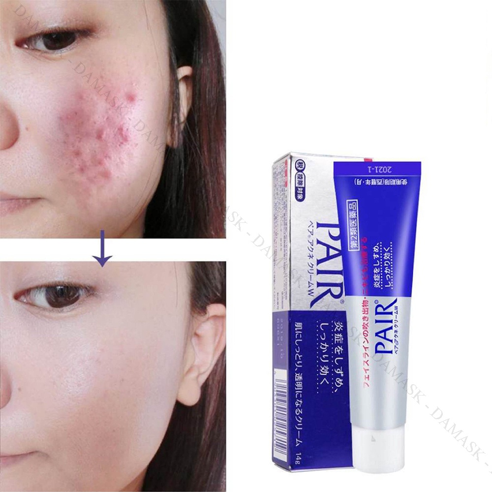 Kem Pair Acne W Cream Nhật Bản