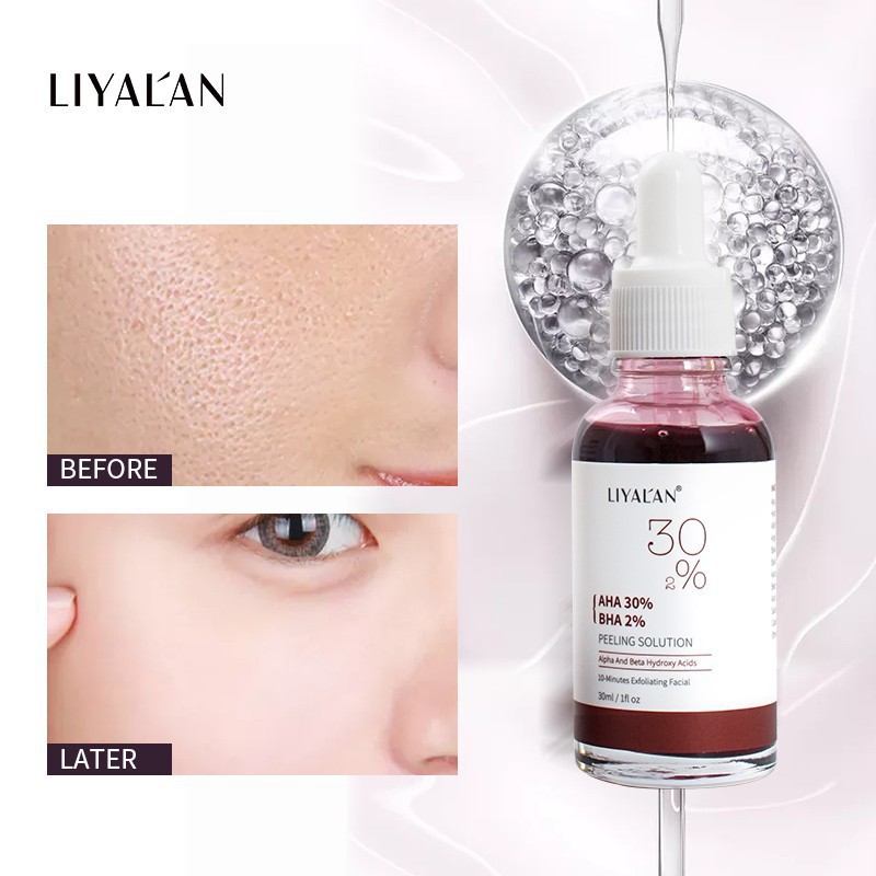 Tinh chất LIYAL'AN Aha  Bha  dạng lỏng chăm sóc da mặt hiệu quả 30ml