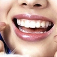 🍉Miếng Dán Trắng Răng 3D White Teeth Whitening Strips Cao Cấp Nội Địa Trung DUASHOP.