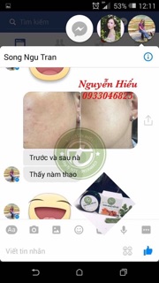 KEM NGHỆ NẾP ĐỎ