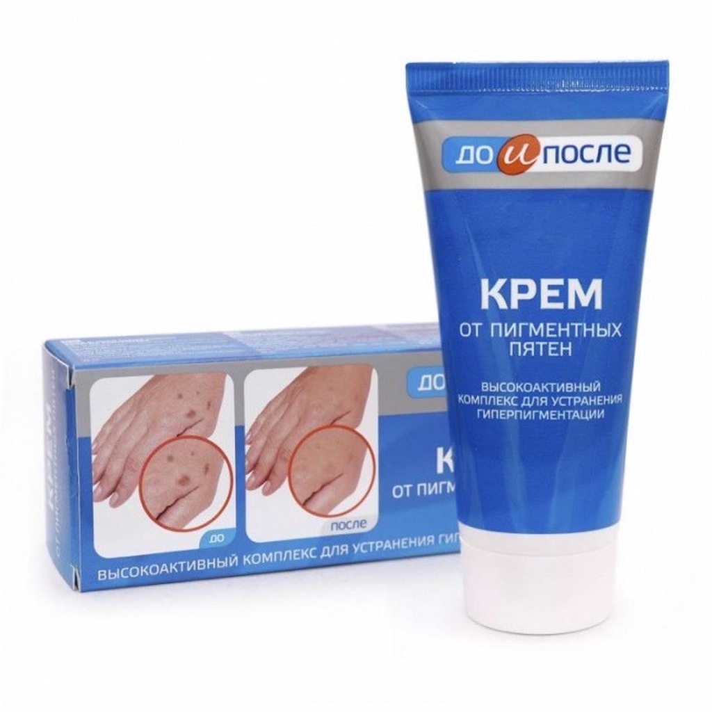 Kem bôi mờ đồi mồi Kpem Nga