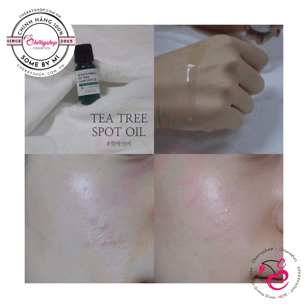💥🍒Tinh Dầu Tràm Trà "Thần Kỳ" Some By Mi 30 Days Miracle Tea tree Clear spot oil