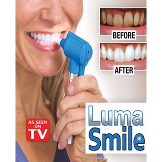 Dụng Cụ Làm Trắng Răng LUMA SMILE