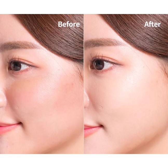Kem Che Khuyết Điểm Cho Làn Da Hoàn Hảo AprilSkin Perfect Spot Erasing Puff Concealer SPF30/PA++ 10g | BigBuy360 - bigbuy360.vn