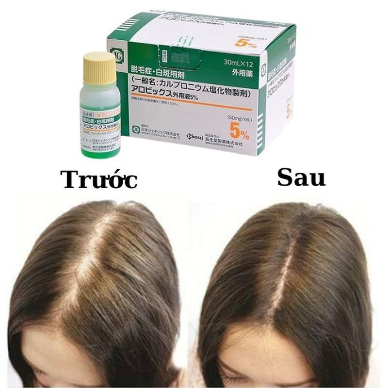 Tinh Chất Kích Thích Mọc Tóc Chosei 5% 30ml