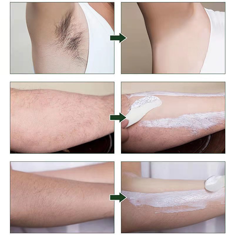 Tẩy lông không đau kem tẩy lông vĩnh viễn ức chế sự phát triển lông thân