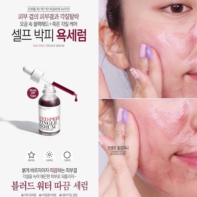 [SAMPLE] Tinh Chất Red Peel Tingle Serum Sample Dạng Gói So Natural (2,5ml)