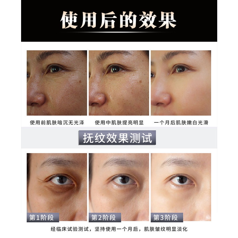 Kem polypeptide Yanjiayi 50g Dưỡng Ẩm Làm Săn Chắc Da Chống Nếp Nhăn Làm Trắng Da