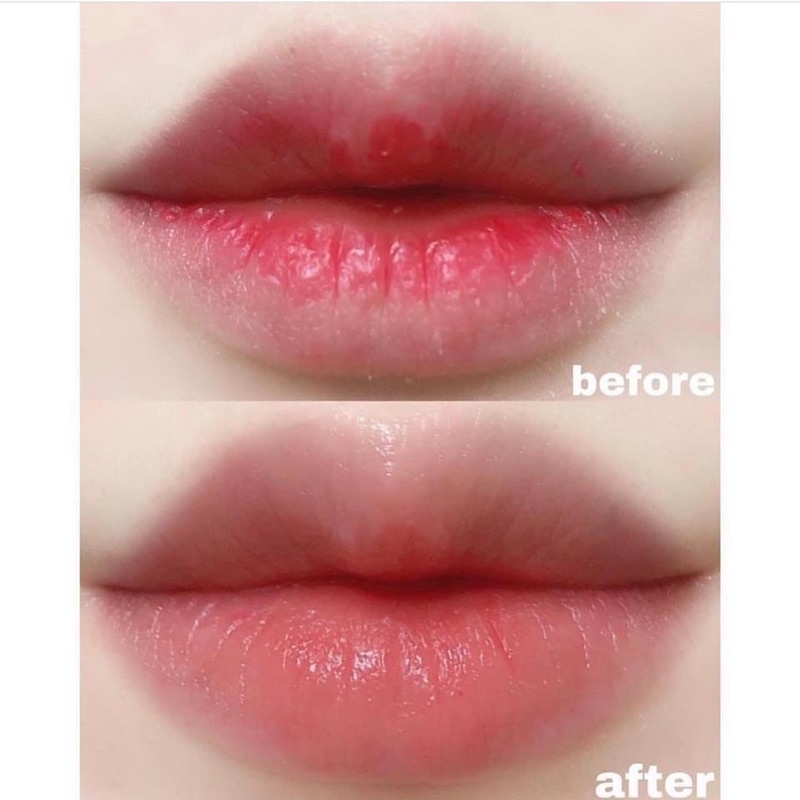 MẶT NẠ MÔI BERRISOM SOS ESSENCE LIP PATCH