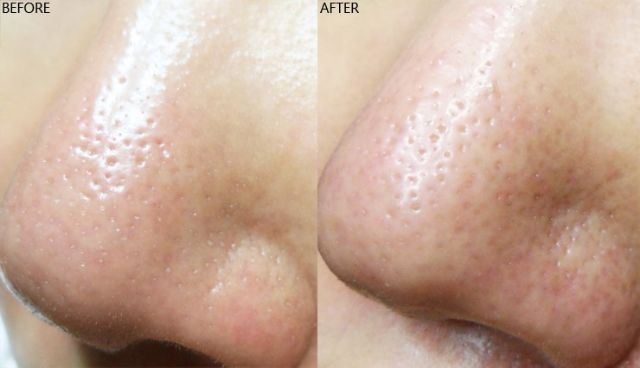 Thanh lăn mụn cám đầu đen vùng mũi cằm Mamonde Pore Clean Blackhead Stick